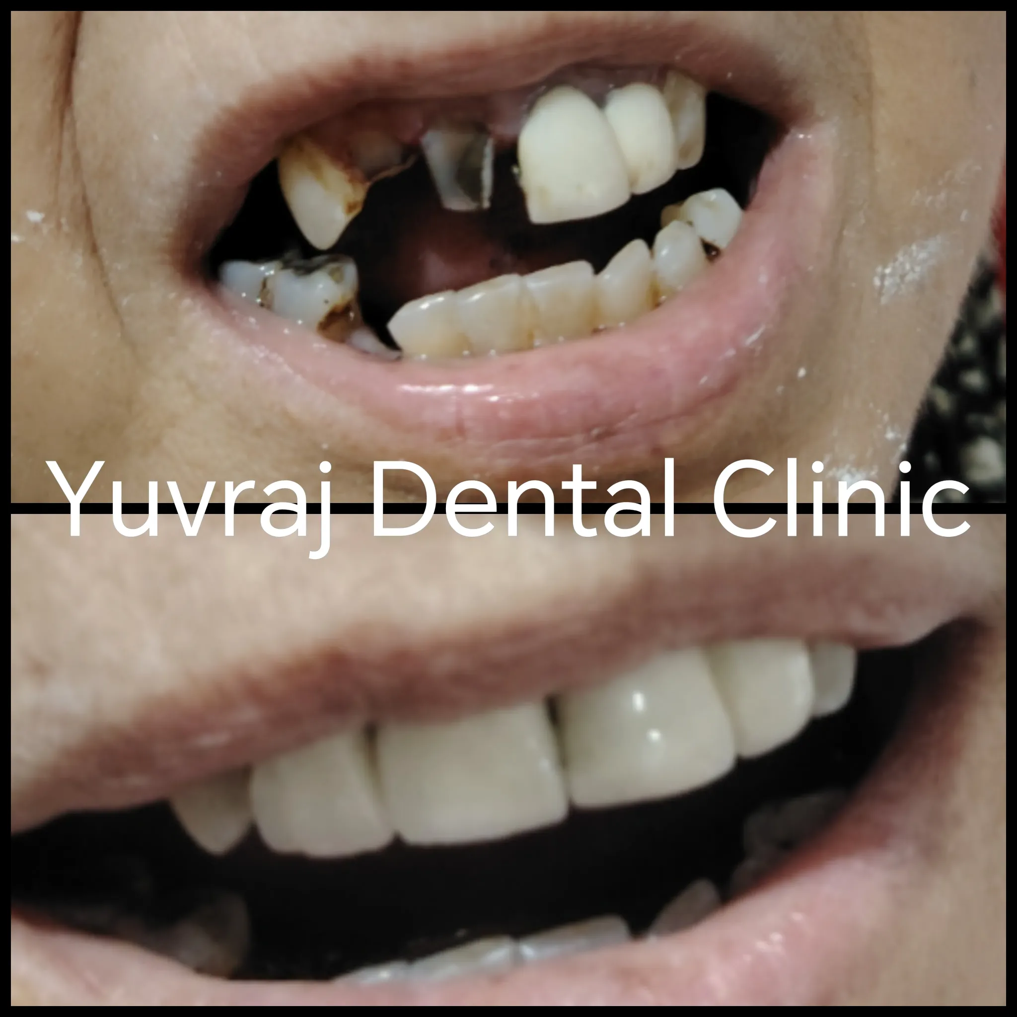Dental treatment result