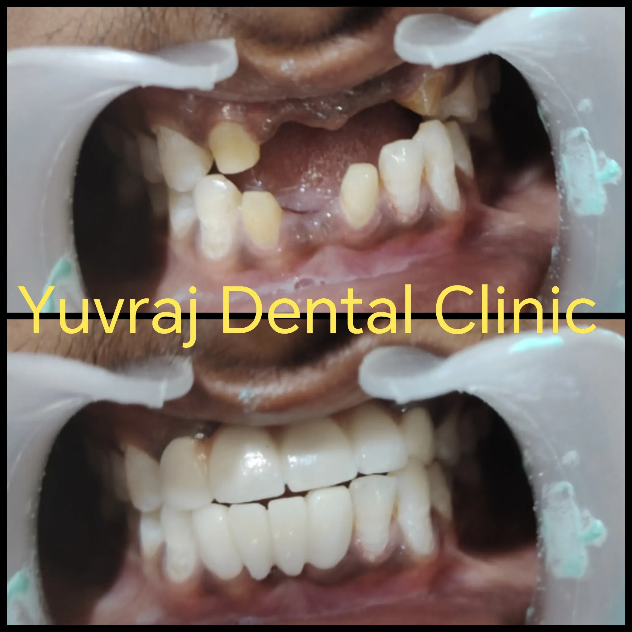 Dental treatment result