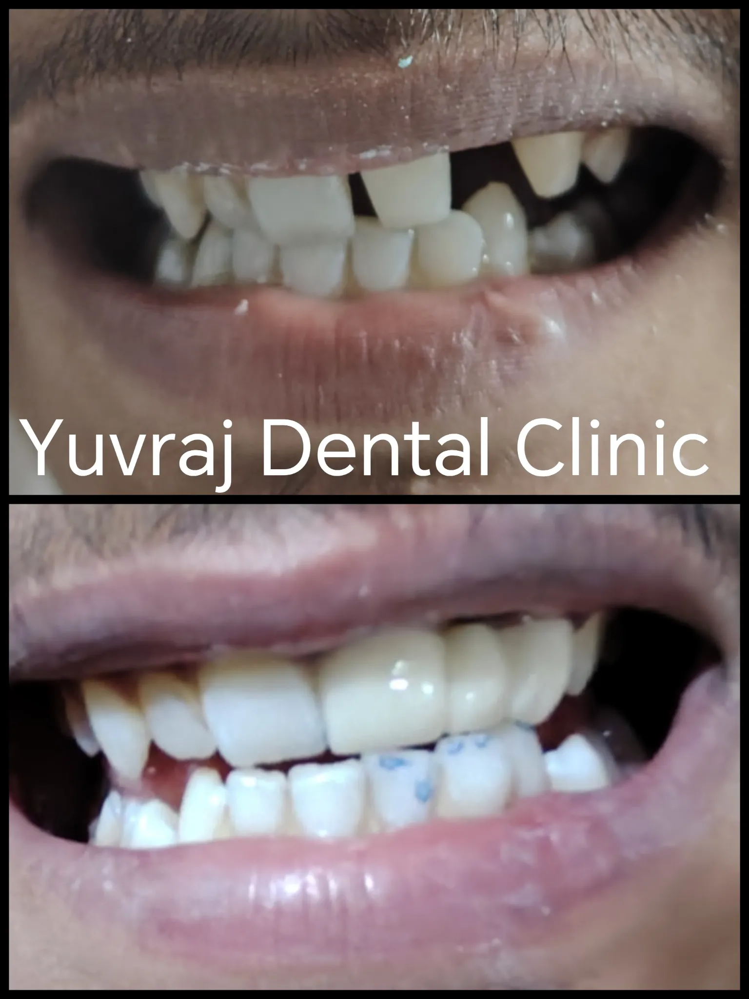 Dental treatment result