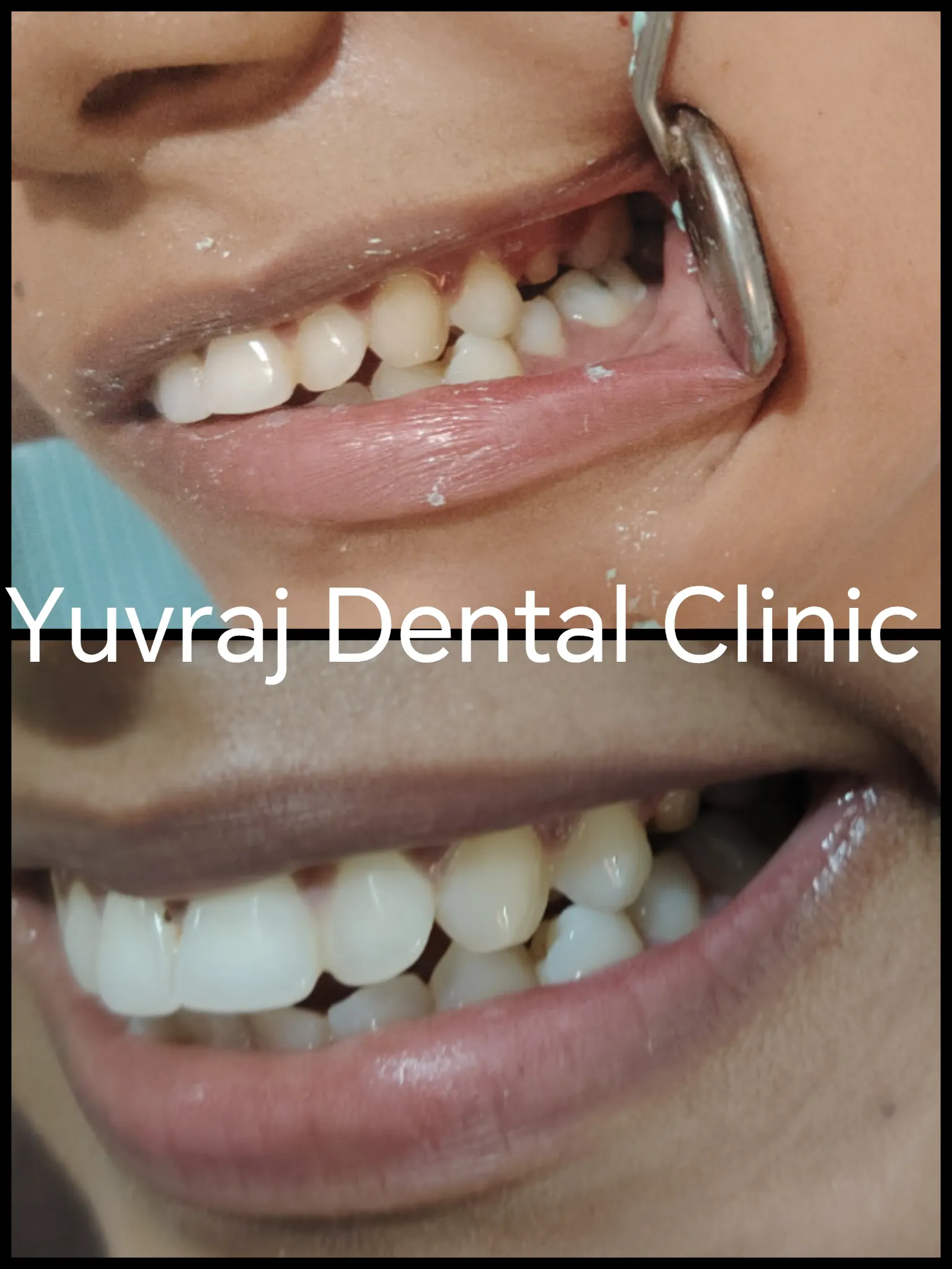 Dental treatment result